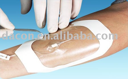 transparent wound dressing 